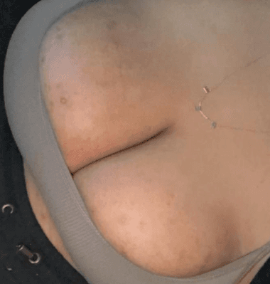 BBW Kalii